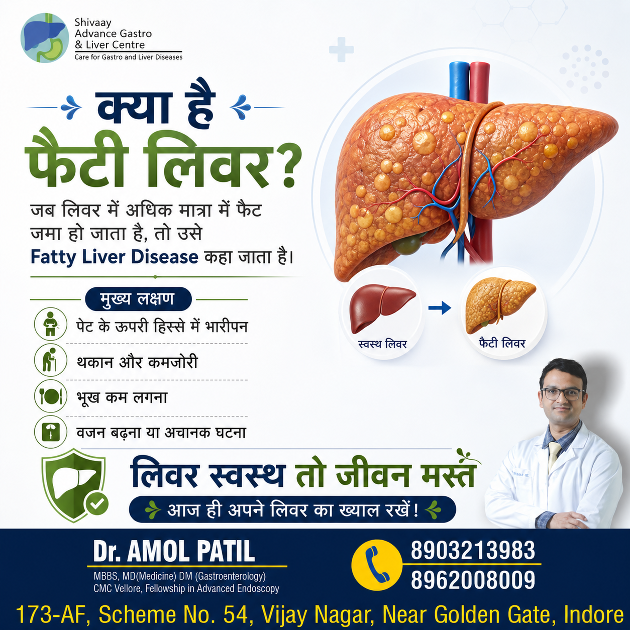 Treatment Of Fatty Liver In Indore